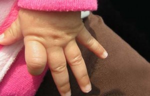 Photo of small girl's hands